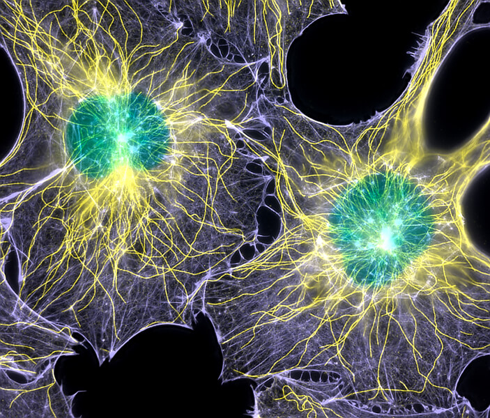 A colorized microscopy photograph of two fibroblast cells.
